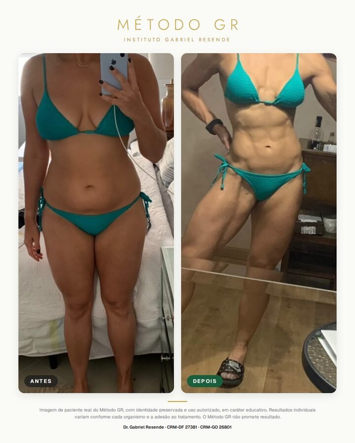 Antes e depois de paciente do Instituto (uso autorizado)